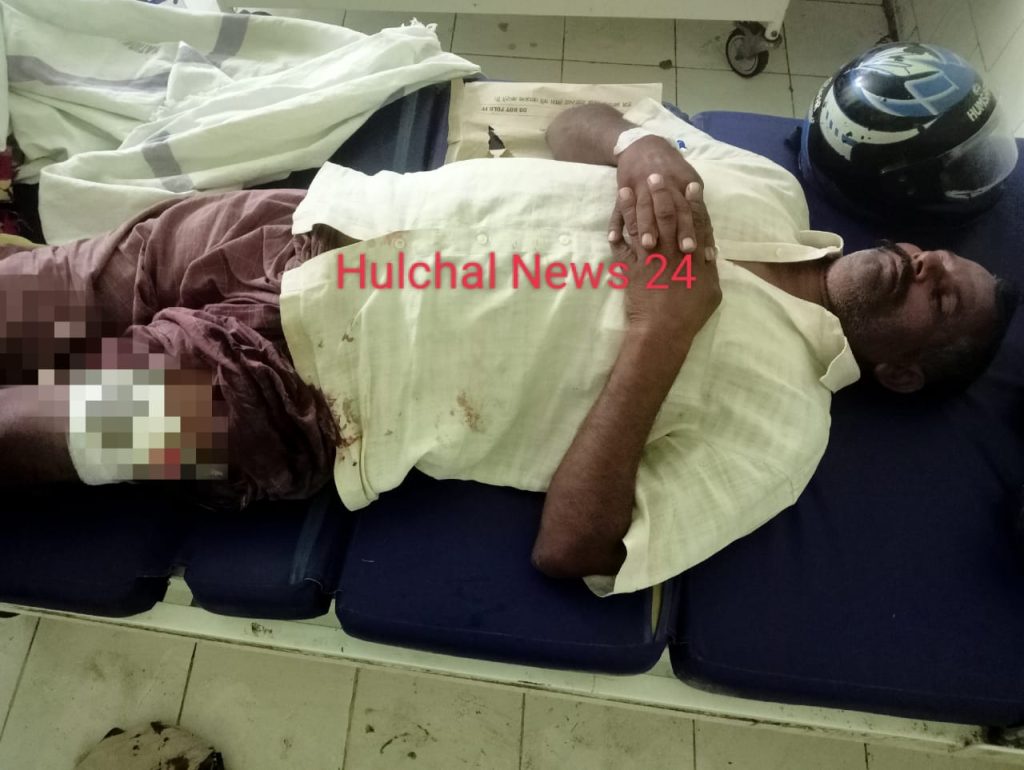 छपरा में बदमाशों ने एक व्यक्ति के घर पर चढ़कर की फायरिंग ; एक व्यक्ति क पैर में लगी गोली, भर्ती
