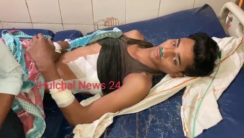 छपरा शहर में दो जगहों पर चाकूबाजी ; मोबाइल लूट के दौरान एक युवक को चाकू घोंपा ; दोनो रेफर