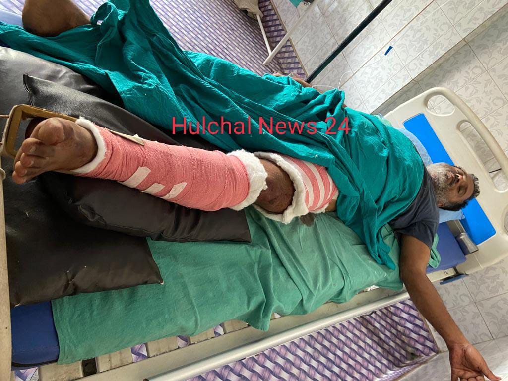 ट्रैक्टर पार्ट्स सह एग्रीकल्चर व्यवसायी को बेखौफ अपराधियों ने मारी गोली, रेफर ; दो बाइक सवार आधा दर्जन अपराधियों ने घटना को दिया अंजाम