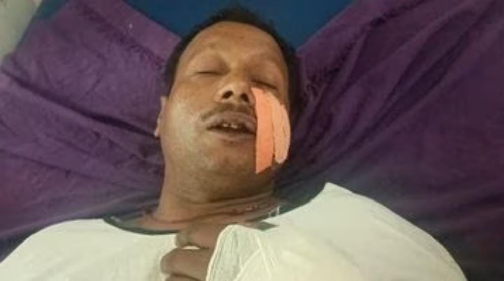 औरंगाबाद से गया बुलाकर एक व्यक्ति को ब’दमाशों ने मा’री गो’ली ; गं’भीर स्थिति में रे’फर