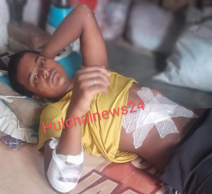 करीमचक मोहल्ला में हुई चा’कूबाजी में एक छात्र गंभीर