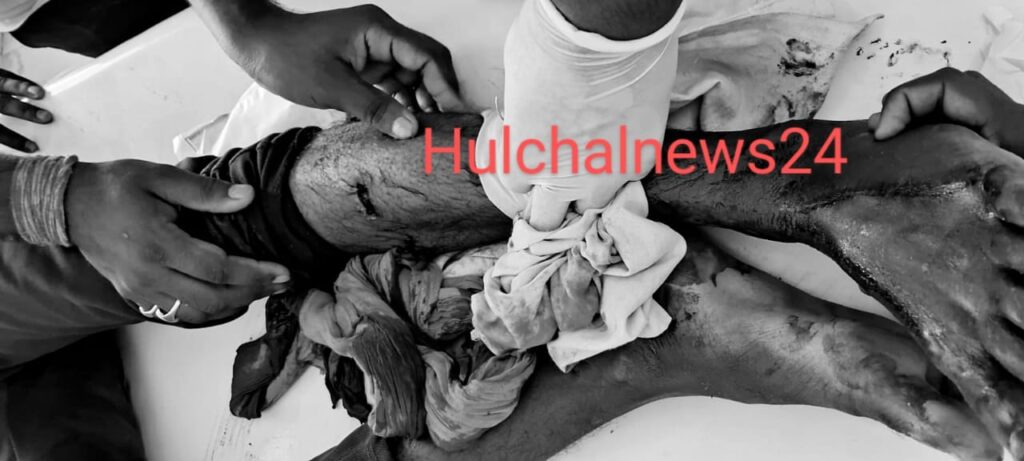 दिनदहाड़े बाइक सवार अपराधियों ने युवक को मारी गोली