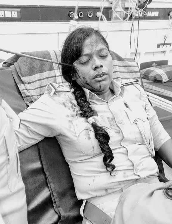अवैध कब्जा हटाने गई पुलिस पर ग्रामीणों ने किया तीर से हमला ; महिला दरोगा के चेहरे पर लगा तीर