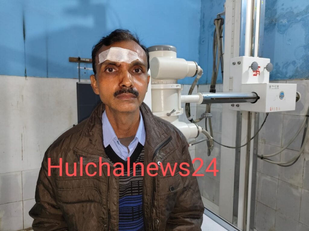 शहर में व्यवसायी को दुकान से खींचकर रॉड से मार कर किया जख्मी ; नामजद प्राथमिकी में गल्ला से रुपया छीनने का भी लगा आरोप