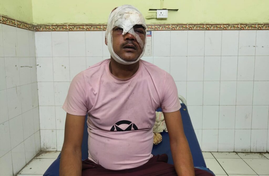 पहले तोड़ा था एंबुलेंस का सीसा ; शिकायत के बाद लाठी डंडे से मारपीट कर फोड़ दिया सिर ; नामजद प्राथमिकी दर्ज