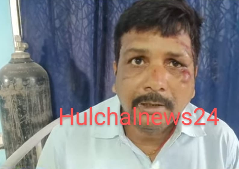लीला पैलेस के पास हो गया खेला : दिनदहाड़े बाइक में टक्कर मार एक लाख रुपए का थैला ले उड़े बदमाश, पीछे लगी पुलिस
