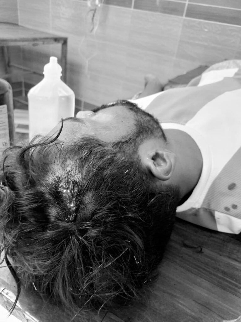 जदयू नेता के पुत्रों के साथ मारपीट, पत्नी भी जख्मी ; रंगदारी मांगने का लगाया आरोप