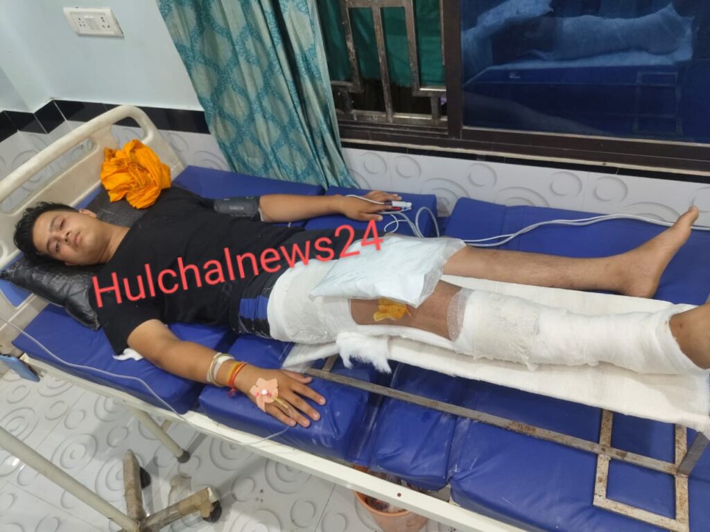 ‘का हित का हाल बा’ इतना कहना युवक को पड़ गया महंगा ; रॉड से मारपीट कर तोड़ा गया पैर, होगा ऑपरेशन