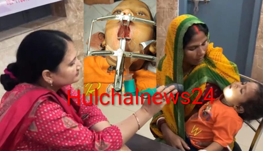 बच्चों के कटे होंठ व तालु का निशुल्क ऑपरेशन छपरा में भी हुआ संभव ; जाने कहां और कैसे निशुल्क होगा ऑपरेशन
