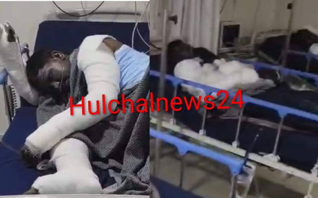 बेंगलुरु में गैस रिसाव से एक हीं कमरे में रह रहे सारण के पांच मजदूर झुलसे ; दो की हालत गंभीर