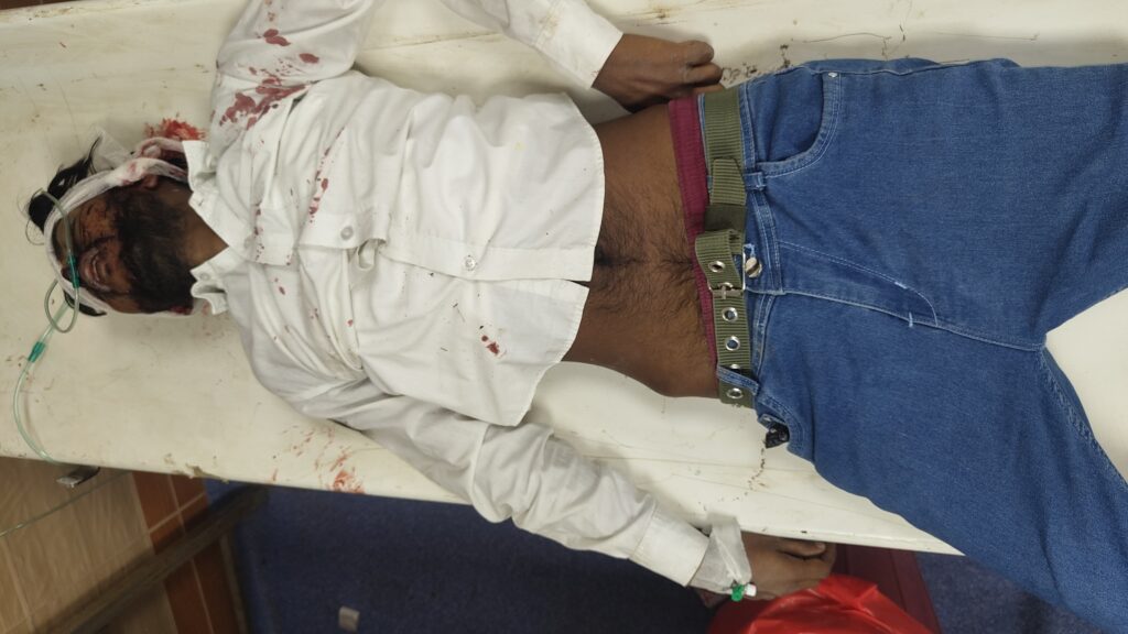 सदर अस्पताल में उचित उपचार के अभाव में जिंदगी की जंग हार गया वह युवक ; 72 घंटे तक शव को रखा जाएगा सुरक्षित