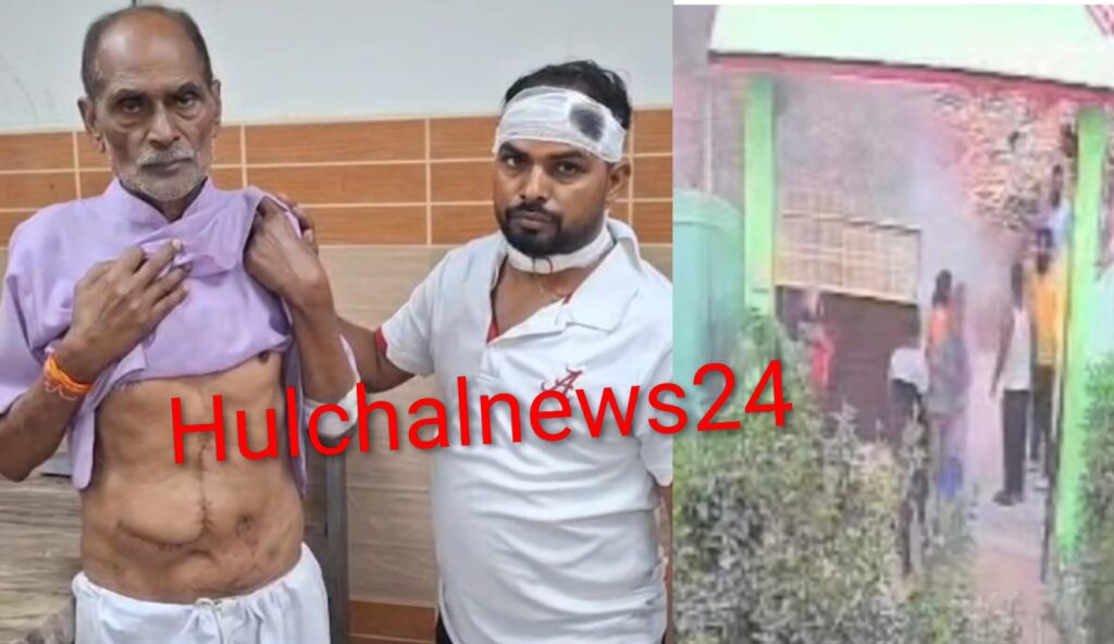 कूड़ा जलाने के विवाद में चले लाठी-डंडे पिता-पुत्र जख्मी