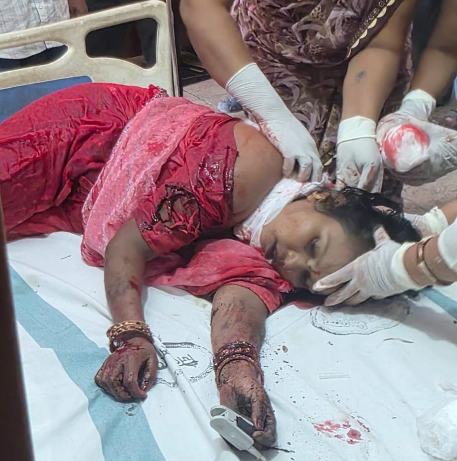कार सवार बदमाशों ने महिला के गले पर धारदार हथियार से प्रहार कर कार से सड़क पर फेंका ; अस्पताल ले जाने के दौरान रास्ते में हुई मौत, सनसनी